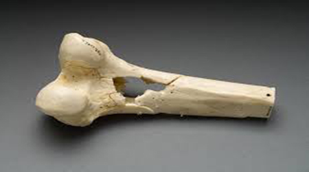 البوابة الطبية | أخبار يومية لحياة صحية