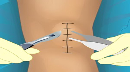 البوابة الطبية | أخبار يومية لحياة صحية