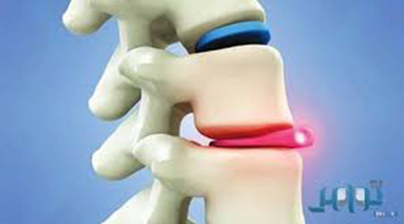 البوابة الطبية | أخبار يومية لحياة صحية