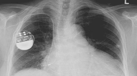 البوابة الطبية | أخبار يومية لحياة صحية