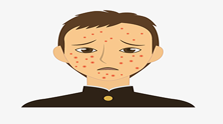 البوابة الطبية | أخبار يومية لحياة صحية