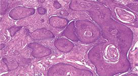 البوابة الطبية | أخبار يومية لحياة صحية