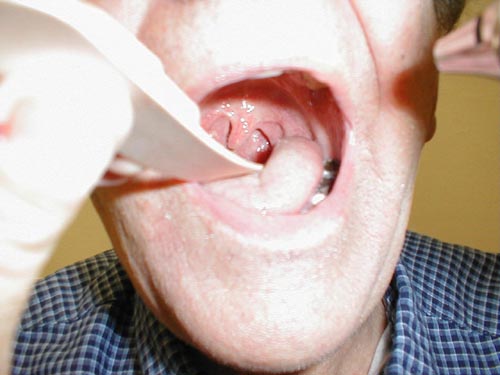 البوابة الطبية | أخبار يومية لحياة صحية