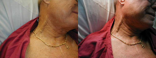 البوابة الطبية | أخبار يومية لحياة صحية