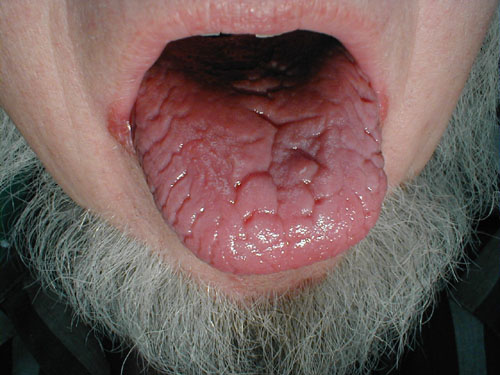 البوابة الطبية | أخبار يومية لحياة صحية