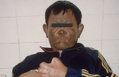 البوابة الطبية | أخبار يومية لحياة صحية