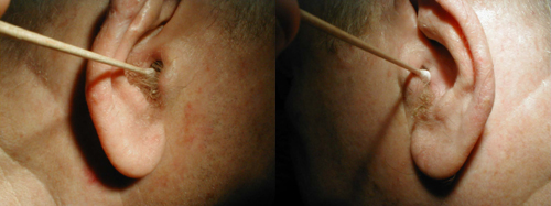 البوابة الطبية | أخبار يومية لحياة صحية