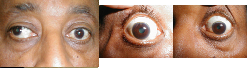 البوابة الطبية | أخبار يومية لحياة صحية