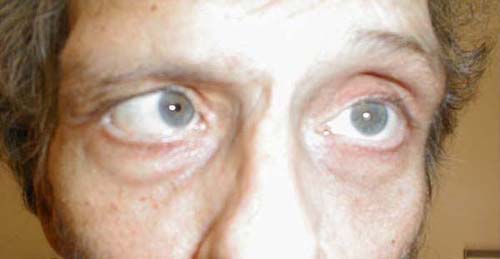 البوابة الطبية | أخبار يومية لحياة صحية