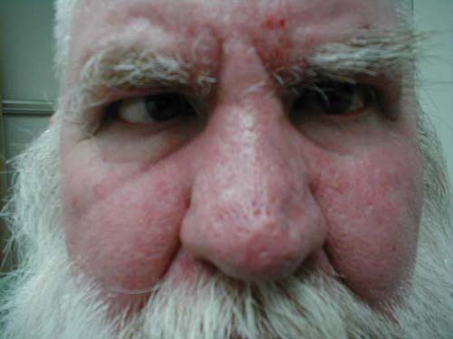 البوابة الطبية | أخبار يومية لحياة صحية