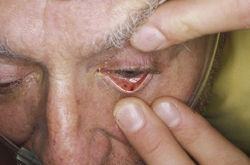 البوابة الطبية | أخبار يومية لحياة صحية