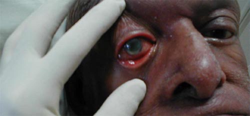 البوابة الطبية | أخبار يومية لحياة صحية