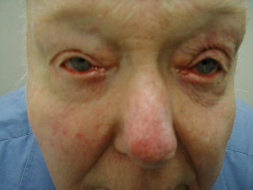 البوابة الطبية | أخبار يومية لحياة صحية