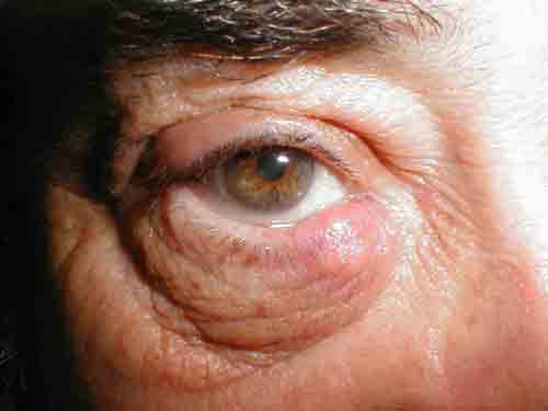 البوابة الطبية | أخبار يومية لحياة صحية