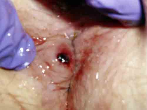 البوابة الطبية | أخبار يومية لحياة صحية