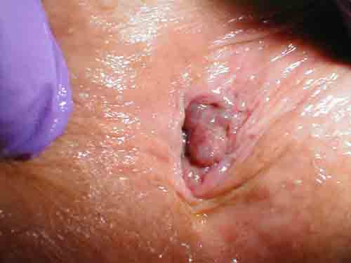 البوابة الطبية | أخبار يومية لحياة صحية