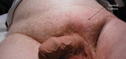 البوابة الطبية | أخبار يومية لحياة صحية