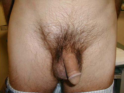 البوابة الطبية | أخبار يومية لحياة صحية