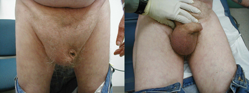 البوابة الطبية | أخبار يومية لحياة صحية