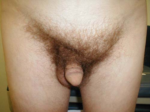 البوابة الطبية | أخبار يومية لحياة صحية