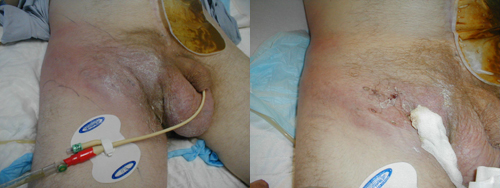 البوابة الطبية | أخبار يومية لحياة صحية