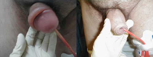 البوابة الطبية | أخبار يومية لحياة صحية