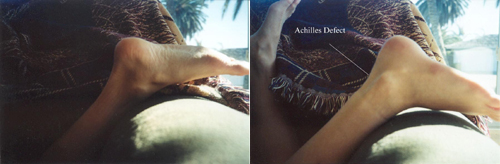 البوابة الطبية | أخبار يومية لحياة صحية