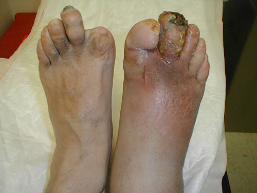 البوابة الطبية | أخبار يومية لحياة صحية