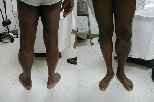 البوابة الطبية | أخبار يومية لحياة صحية