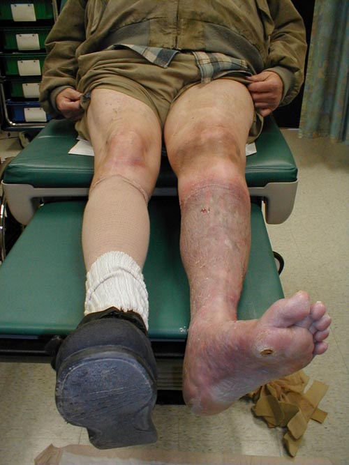 البوابة الطبية | أخبار يومية لحياة صحية