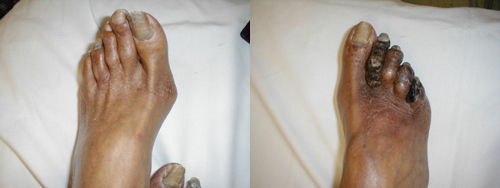 البوابة الطبية | أخبار يومية لحياة صحية