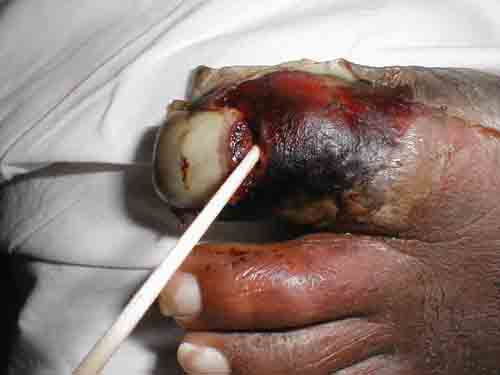 البوابة الطبية | أخبار يومية لحياة صحية