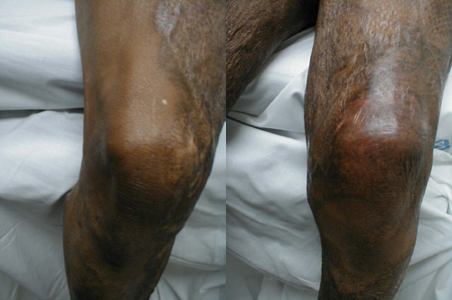 البوابة الطبية | أخبار يومية لحياة صحية