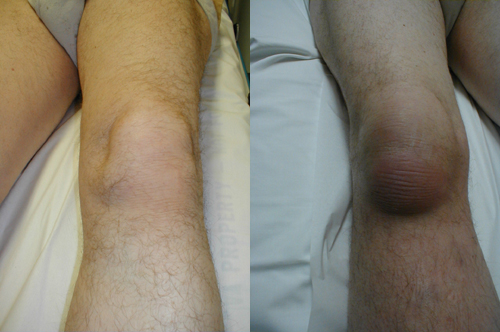 البوابة الطبية | أخبار يومية لحياة صحية