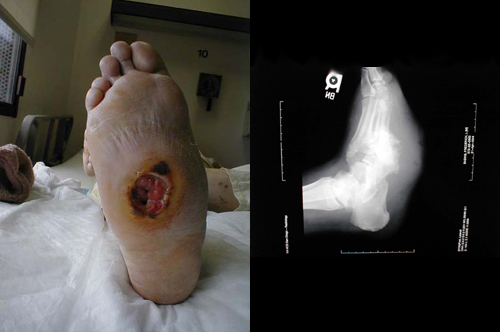البوابة الطبية | أخبار يومية لحياة صحية