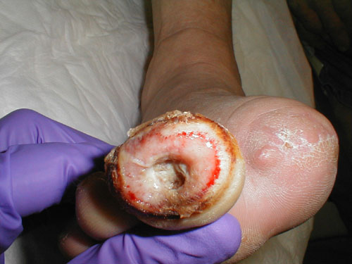 البوابة الطبية | أخبار يومية لحياة صحية