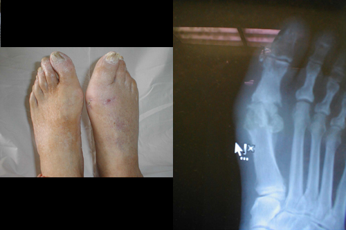 البوابة الطبية | أخبار يومية لحياة صحية