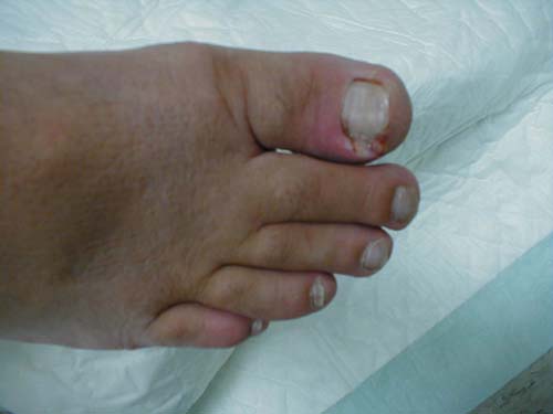 البوابة الطبية | أخبار يومية لحياة صحية