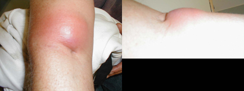 البوابة الطبية | أخبار يومية لحياة صحية