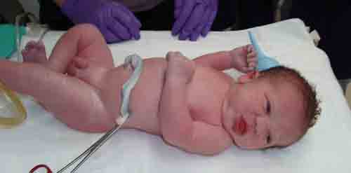 البوابة الطبية | أخبار يومية لحياة صحية