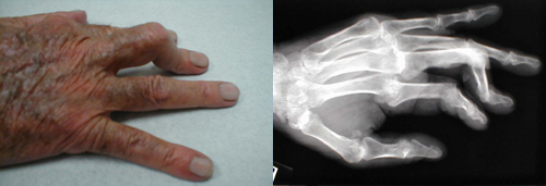 البوابة الطبية | أخبار يومية لحياة صحية