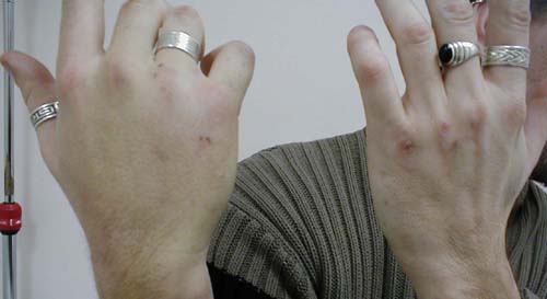 البوابة الطبية | أخبار يومية لحياة صحية