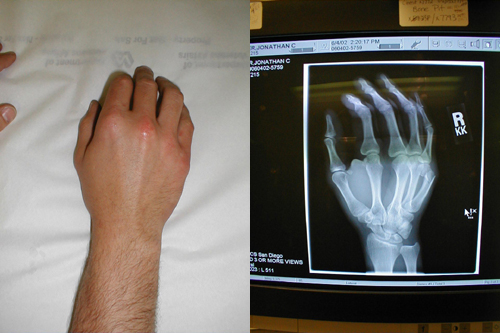 البوابة الطبية | أخبار يومية لحياة صحية