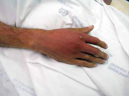 البوابة الطبية | أخبار يومية لحياة صحية