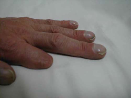 البوابة الطبية | أخبار يومية لحياة صحية