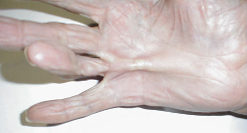 البوابة الطبية | أخبار يومية لحياة صحية