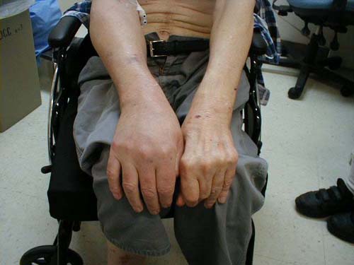 البوابة الطبية | أخبار يومية لحياة صحية