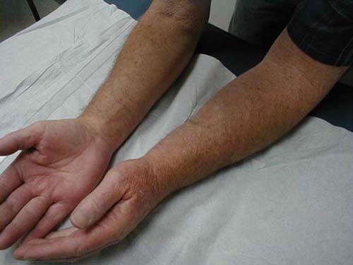 البوابة الطبية | أخبار يومية لحياة صحية