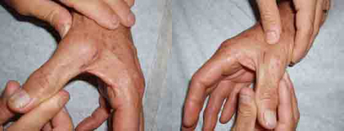 البوابة الطبية | أخبار يومية لحياة صحية