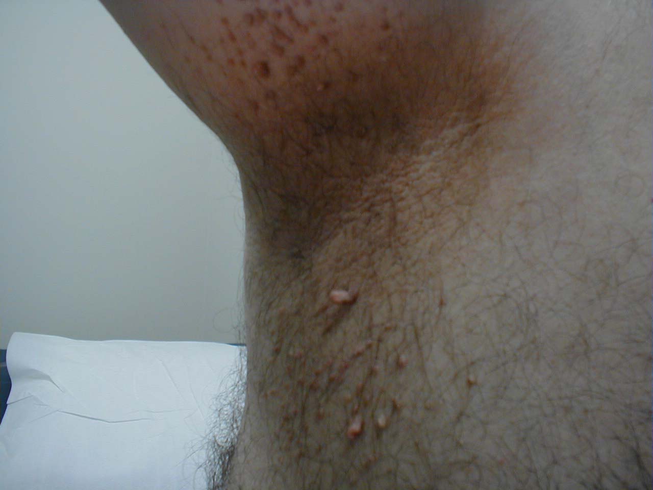 البوابة الطبية | أخبار يومية لحياة صحية